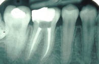 Endodonzia