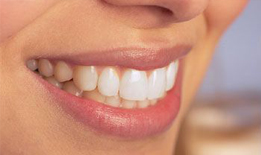 igiene orale e prevenzione
