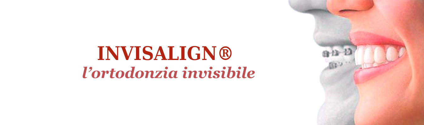Punto di riferimento invisalign e dentista a Novara