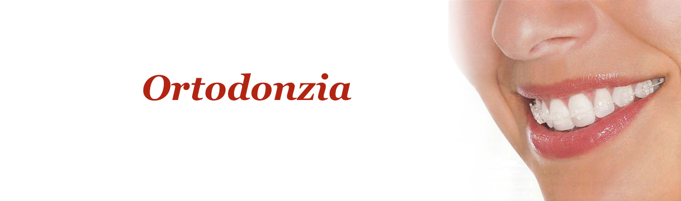 Ortodonzia, apparecchio dentale, implantologia, dentista, Novara