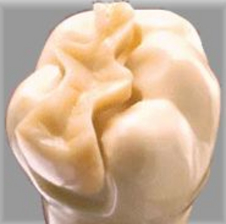 intarsio in ceramica intarsio