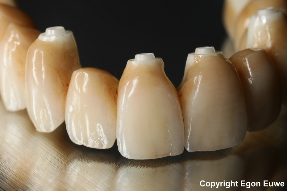 odontoiatria protesica odontoiatria protesica