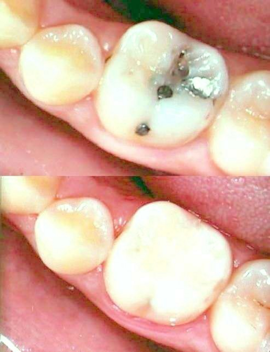 Conservativa prima e dopo Conservativa prima e dopo