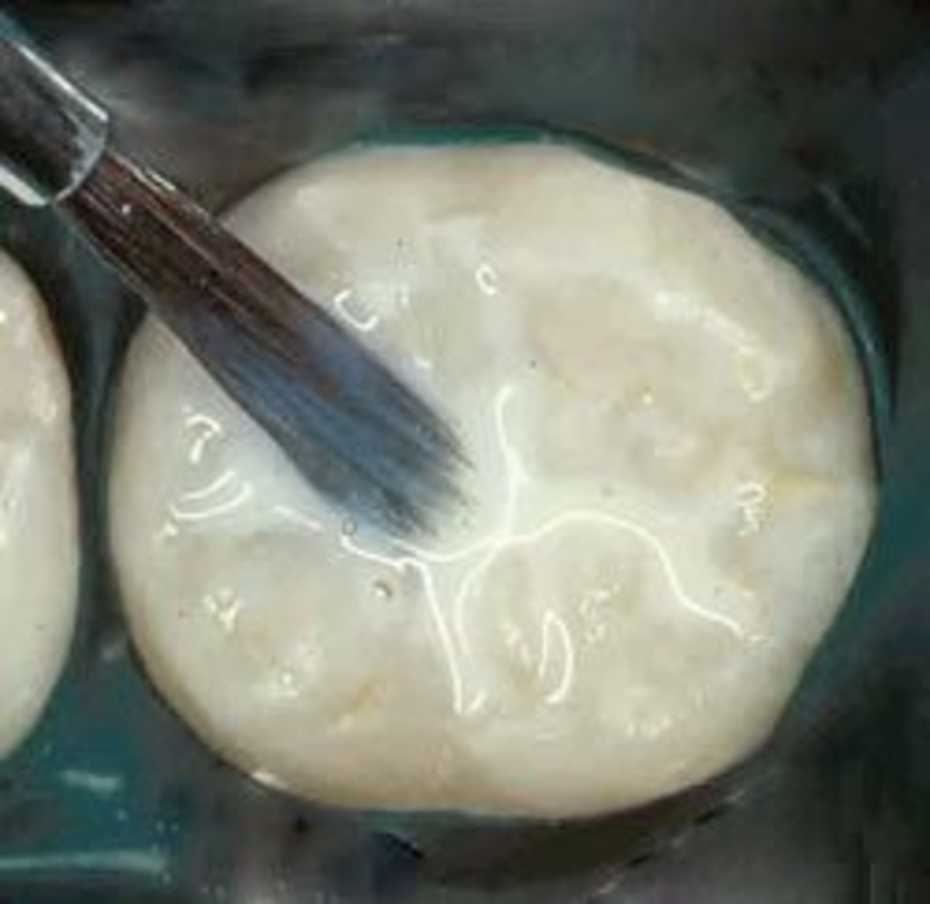 Sigillatura dei solchi Sigillatura dei solchi