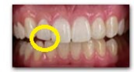 cura dentale cura dentale