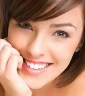 faccette dentali