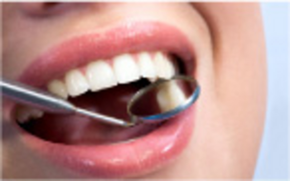 corone dentali corone dentali