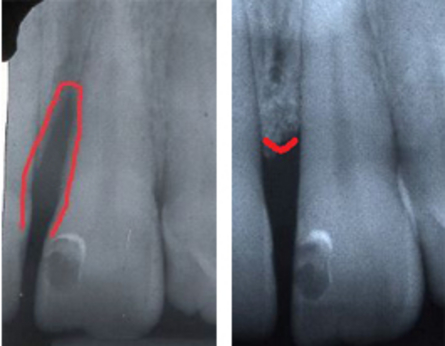 Ricostruttiva Ricostruttiva