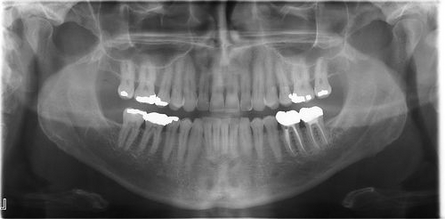 Panoramica Panoramica