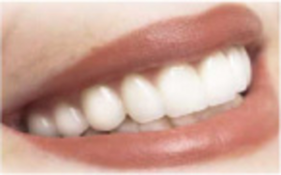 sbiancamento denti Sbiancamento denti